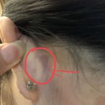 [댓글부탁해] <b>귀</b> <b>뒤</b>에 혹