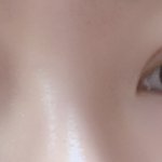 [댓글부탁해] 쌍수 16일차 어떰?? <b>약약</b>혐