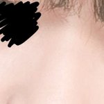 [댓글부탁해] 나 코수술 해야할까..?