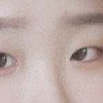 안검<b>하수</b>ㅠㅠ