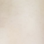 절개 앞트임 <b>눈</b>교 <b>한</b><b>달차</b>인데