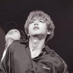박지훈 얼굴 무슨일;