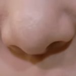 [댓글부탁해] 얘들아 <b>코에</b> 저 자국 뭔지 아는사람?