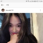 스<b>캐</b> 김혜윤 쌍커풀