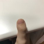 <b>엄지</b>손가락 이렇게 생긴 애 있냐