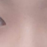 [추반] 나 <b>쌍수</b> 추반좀 ㅠㅠ