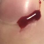 [댓글부탁해] <b>손톱</b>밑에베였는데자살하고싶다