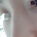[댓글부탁해] 매<b>부리</b>코좀 봐주라ㅜㅜ