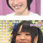 [댓글부탁해] 내가 이런<b>이빨</b>인데 첫인상이 어떠냐 ++++