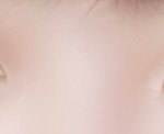 오늘쌍수<b>재수술</b>했는데 잘된걸까?
