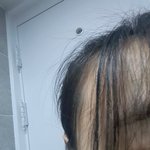 나 머리묶엇는데 <b>탈모</b>같냐,,