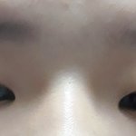 [조언부탁해] 내 코 <b>쉐딩</b> 어또케해