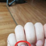 [댓글부탁해] <b>손톱</b> 왜 이렇게 되는지 아는사람ㅠㅠ