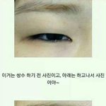 쌍수 전후