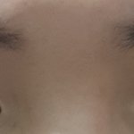 [댓글부탁해] 나 눈 짝짝이 엄청심한거지?