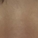 나 안검<b>하수</b> 개심하지 수술 해야겠지 ???!!!?!?!