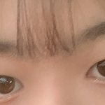쌍수 <b>전후</b> 사진 ㅎㅅㅎ