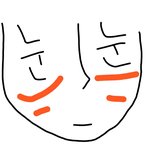 [댓글부탁해] 볼에 <b>주름</b>있는 거 나만그래?