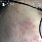 내 피부 보다 나쁜 애 없다에 <b>한표</b>  (혐혐)