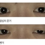 나 안검<b>하수</b> 개심하다 ㅅㅂㅅㅂㅅㅂㅅㅈㅅㅈㅅㅈㅆㅈㅅㅈㅅㅈㅅㅂㅅㅂㅅ...