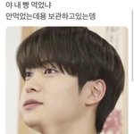 얘들아 나 <b>충치</b>치료비용만 300이래 ㅠ
