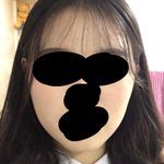 나보다 <b>안면</b>비대칭 심한사람