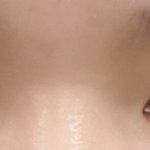 [드루와] 쌍커풀 <b>전후</b>인데 쌍수해야겠지..?