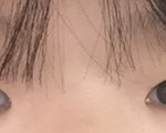 [댓글부탁해] 나 <b>쌍수</b> <b>전</b> 후 어때?