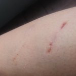 [그냥내얘기] <b>광견병</b>.. 어디 물어 볼 곳이 없어서 30대 게시판에...