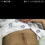 [이것좀봐줘] 돈많은 가해학생 한 사람 장애인 만들어 놓고도 법적...