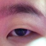 [꼭조언부탁] [<b>쌍수</b>후기]  <b>쌍수</b> 어떤지좀 봐줘 ㅠ