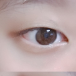 나 쌍수잘될거 같니..?