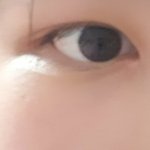 <b>눈</b> <b>옆</b>에 좀 들어간거 뭐지?