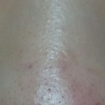 [조언제발] 이런 블랙<b>헤드</b>는 어떻게 없애??