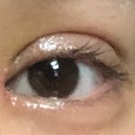 쌍수붓기 ㅃㄹ빠지는법좀제발 ㅠㅠㅠㅠ
