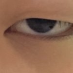 +1년 후에 쌍수 후기로 돌아온다 역대급 <b>변화</b>로 돌아올려고 노력해볼게