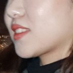 추가) 얼굴살 ㅋㅋㅋㅋ 진짜 어떡해요 (사진ㅇ 혐주의)