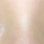 [댓글부탁해] 쌍수 10일차 봐주라ㅠㅠ
