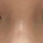 내 코는 어떤 코임?