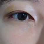 [댓글부탁해] 쌍수 전후<b>사진</b> 올린당.<b>jpg</b>