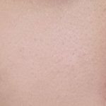 [조언부탁해] 피부 <b>호수</b>