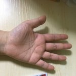 손이 너무 작아 <b>장애</b>같애...