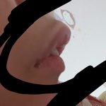 [조언부탁해] +)나 <b>교정</b>해야돼??ㅈㅂ