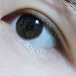 [댓글부탁해] 쌍수 6개월 됐는데 좀 봐주라ㅠㅠ
