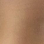 [19] 본인 쌍커풀 수술 추반을 해주세요