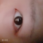 [댓글부탁해] 나 <b>뒤트임</b> 심각하지ㅣ