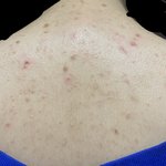 혐주의)))))등<b>드름</b>!!심각!!!!