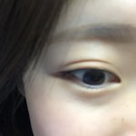 [드루와] 애들아 나 쌍수 할까?ㅠ 진짜 꼭 봐줘