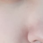 나 피부 많이 나아졌당