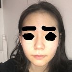 [조언부탁해] 사진<b>복코</b>)코 마사지 3일인데 쫌 차이남..?